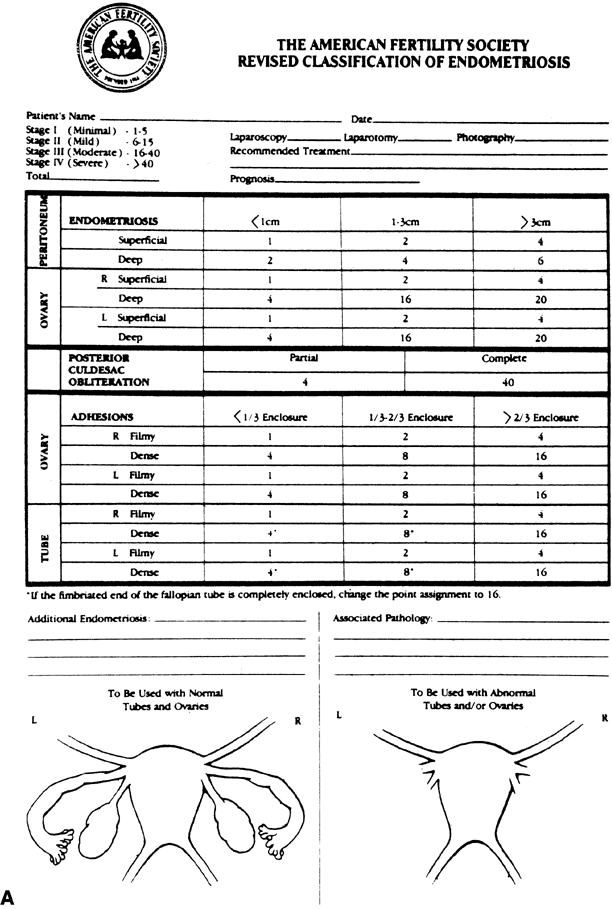 endomtriose rAFS enzian score